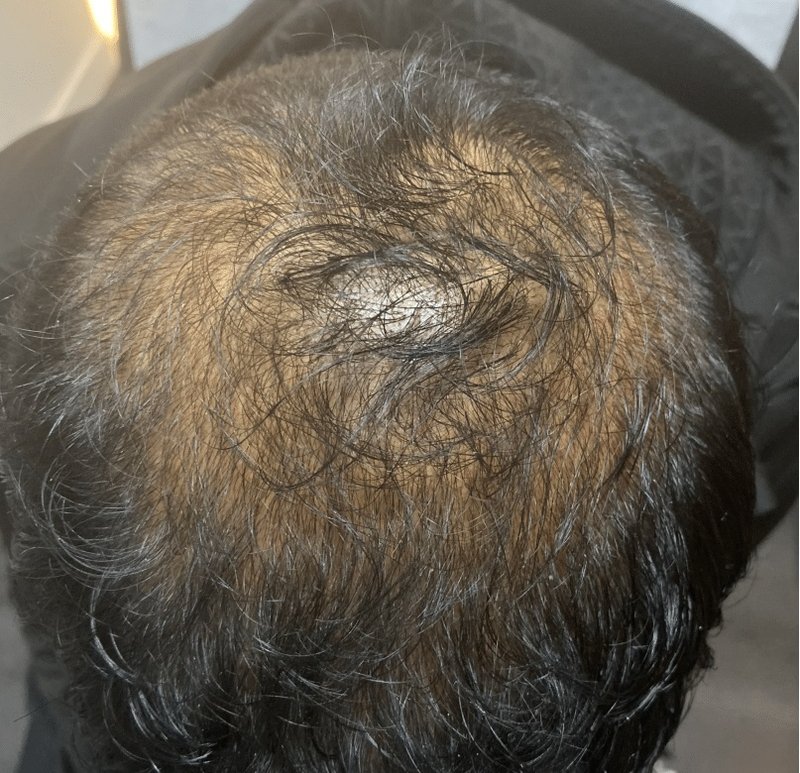 Best hairstim cena w aptece in Poland